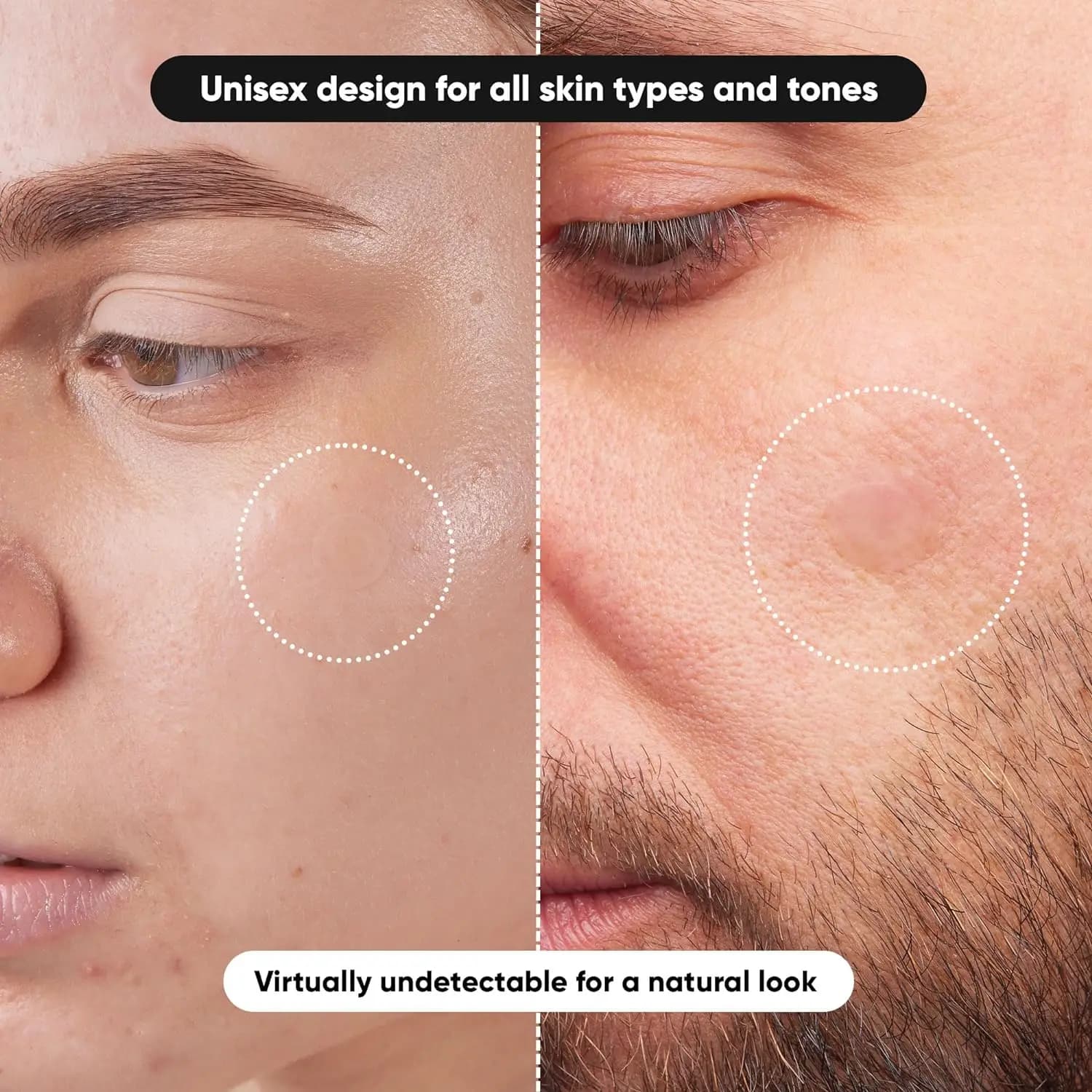 transparent waterproof hydrocolloid acne patch — image 5