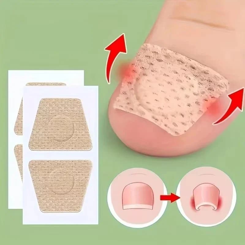 soft nail repair patch for fungal and ingrown nails — image 1