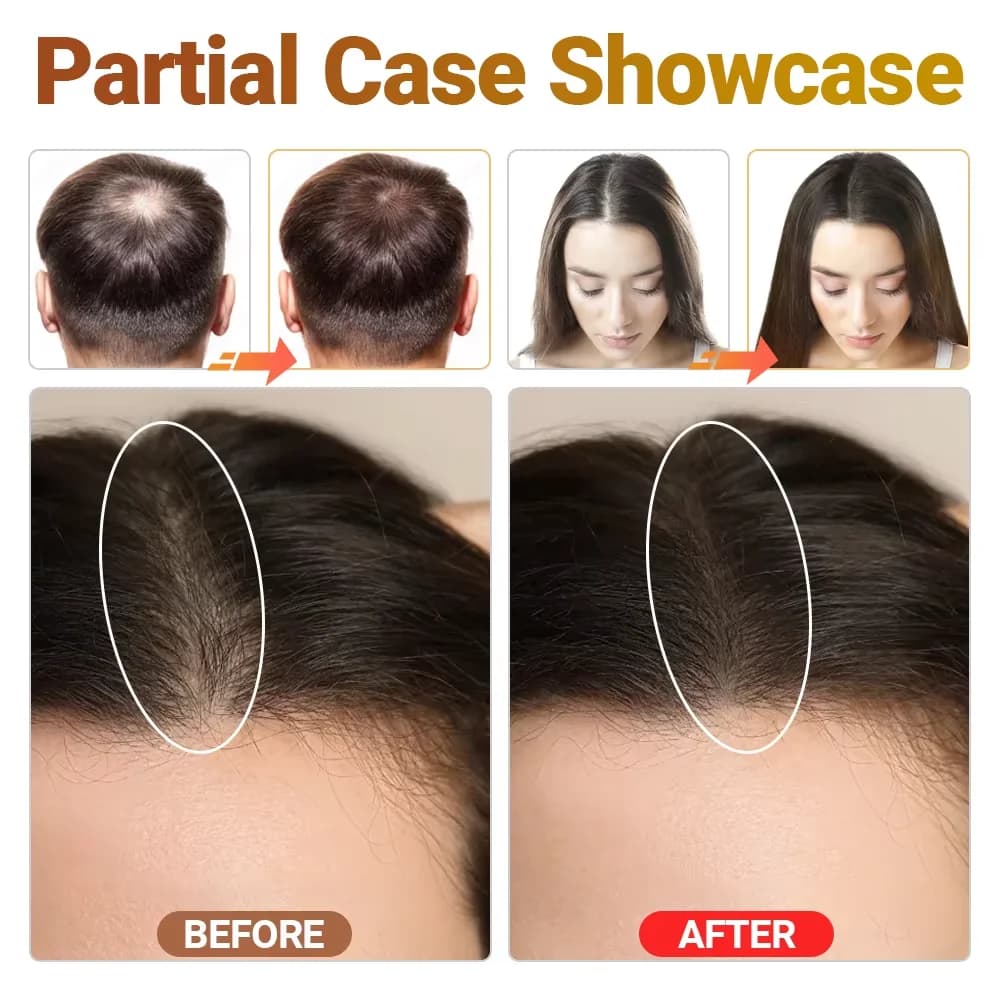 photon hair growth device with triple light therapy — image 3