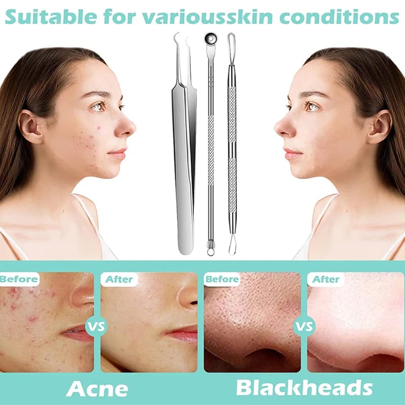 Stainless steel acne and blackhead removal needle — image 2