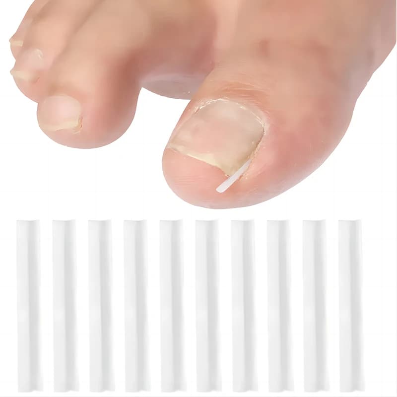 Ingrown toenail correction pad — image 5
