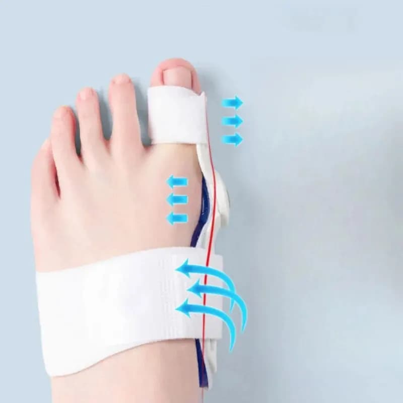 Hallux valgus orthosis shoes for day and night use — image 3