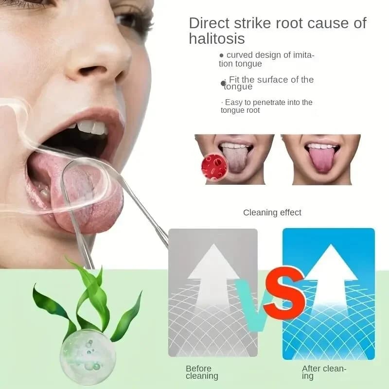 Stainless steel U‑shape tongue scraper — image 4