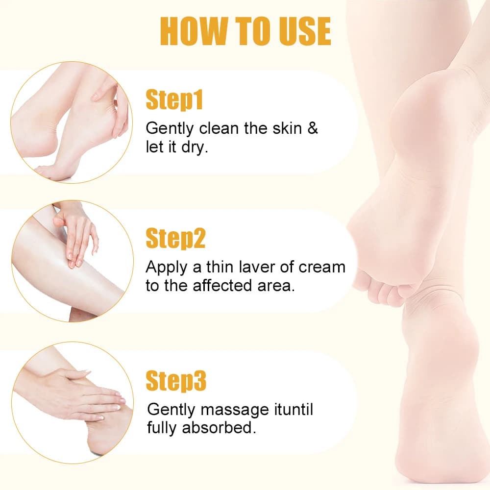 40g ultra hydrating urea foot cream with aloe vera — image 4