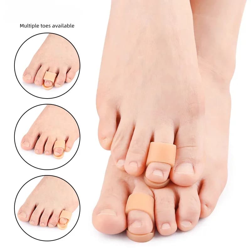 silicone toe straightener and bunion protector pair — image 2