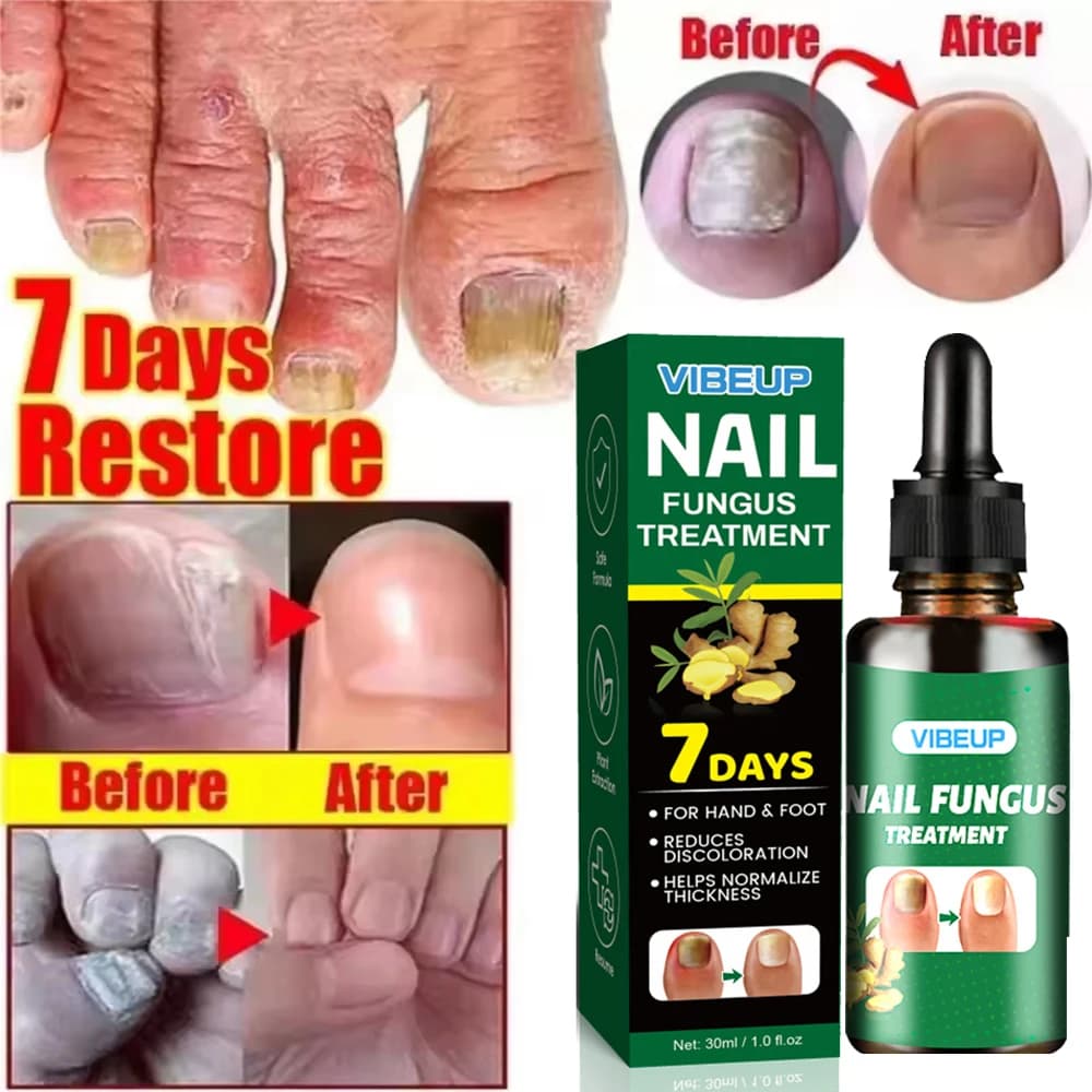 Fungal nail treatment serum bottle — image 4