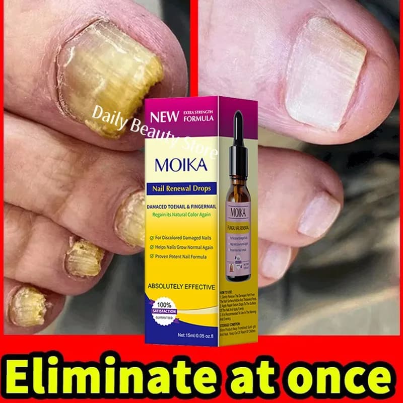 nail fungus treatment serum bottle — image 3