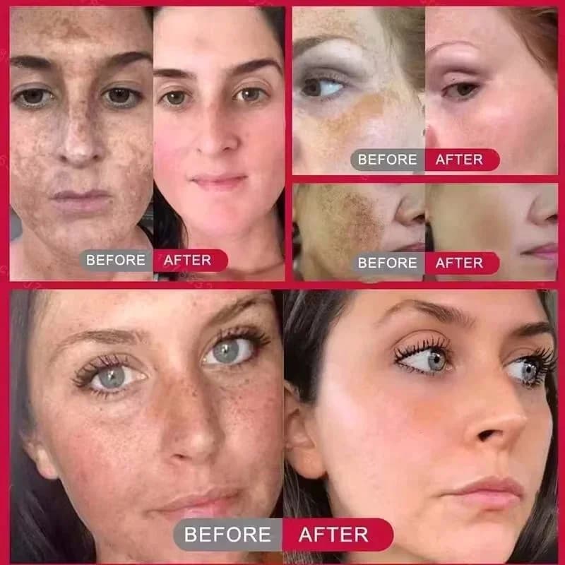 Spot-removing brightening cream tube — image 2