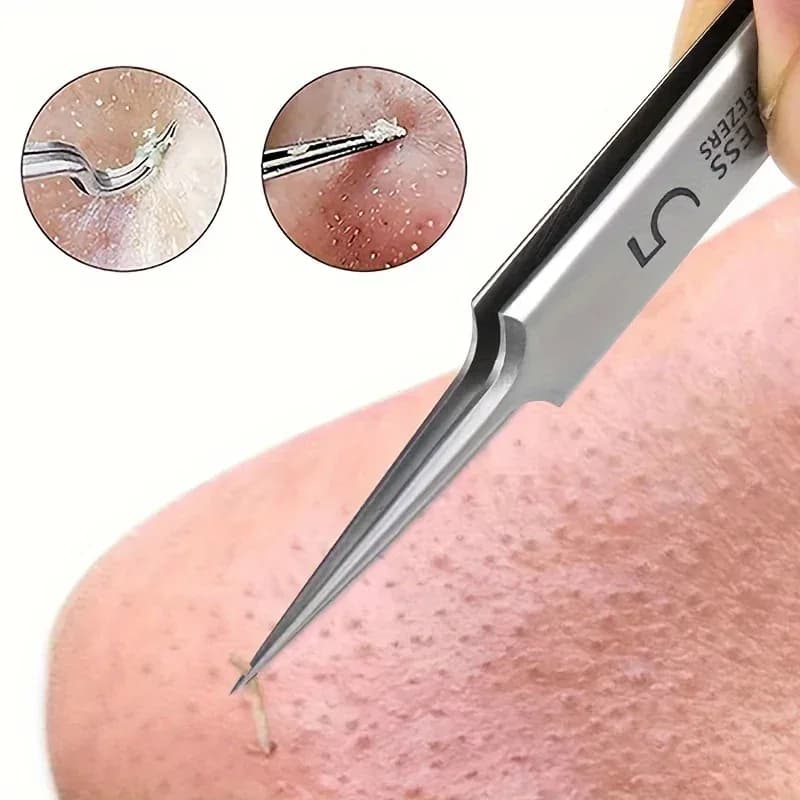 Extra Fine #5 Acne & Blackhead Removal Tweezers
