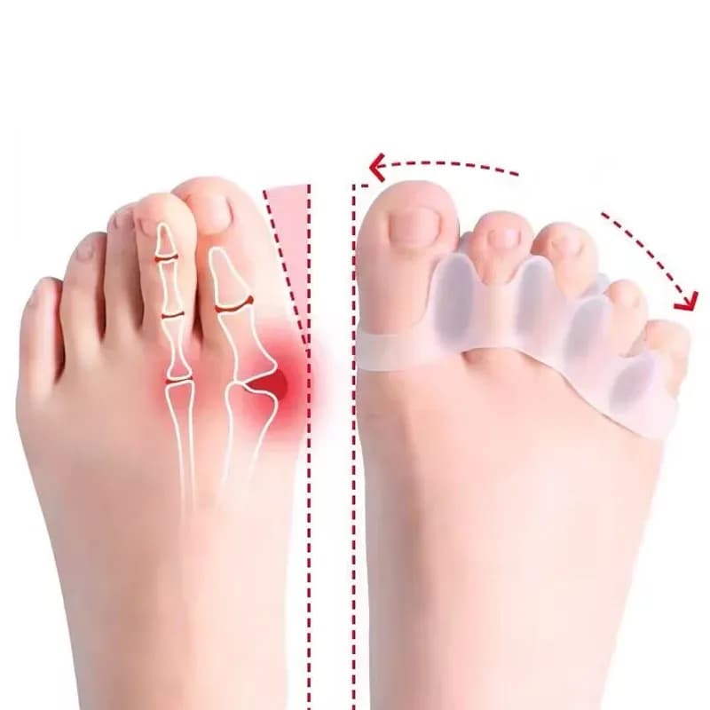 Silicone Toe Separator Set – 2 Pair