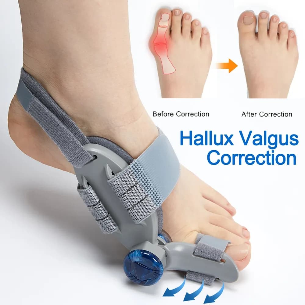 Bunion Splint for Hallux Valgus Correction