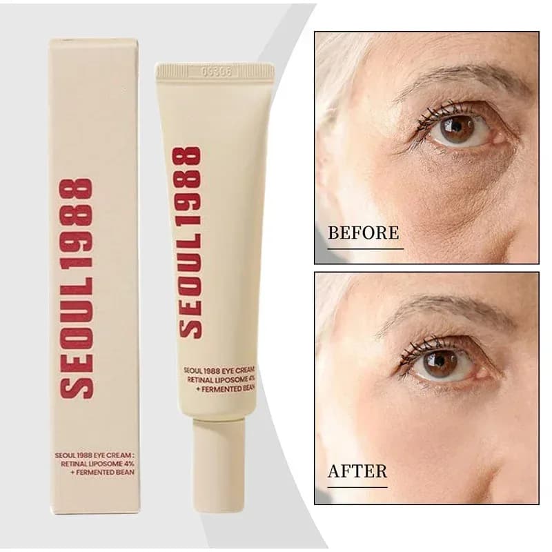 Seoul 1988 Retinol Eye Cream – 4%