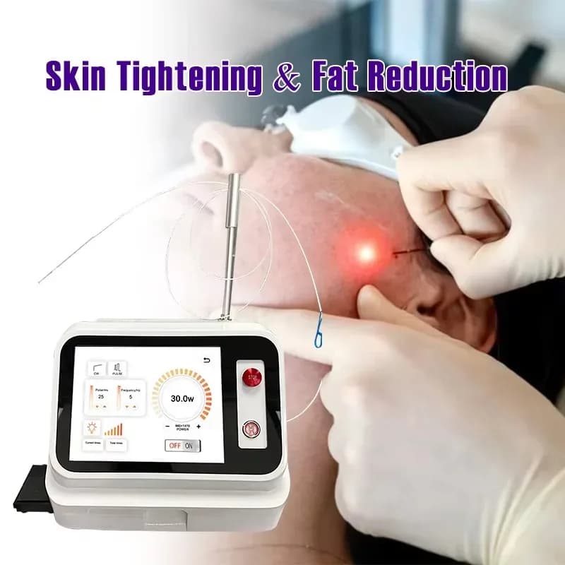 Laser Endo Facelifting 1470nm Laser Liposuction Endolifting Skin
