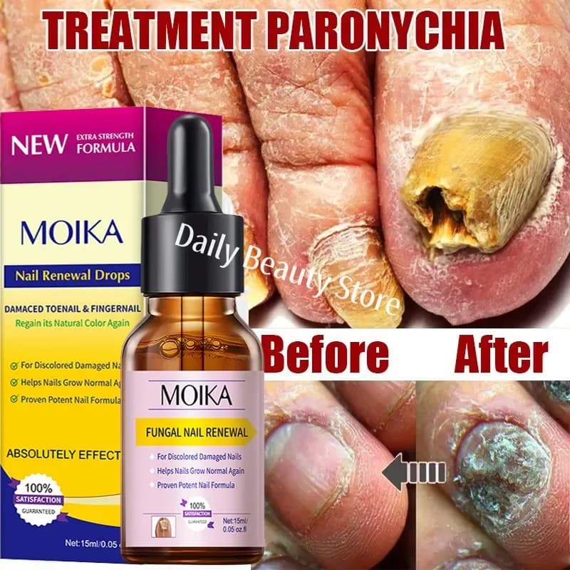 Nail Fungus Treatment Serum