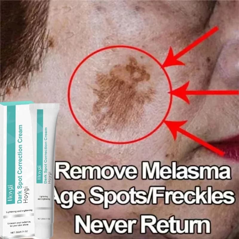 Spot‑Removing Brightening Cream