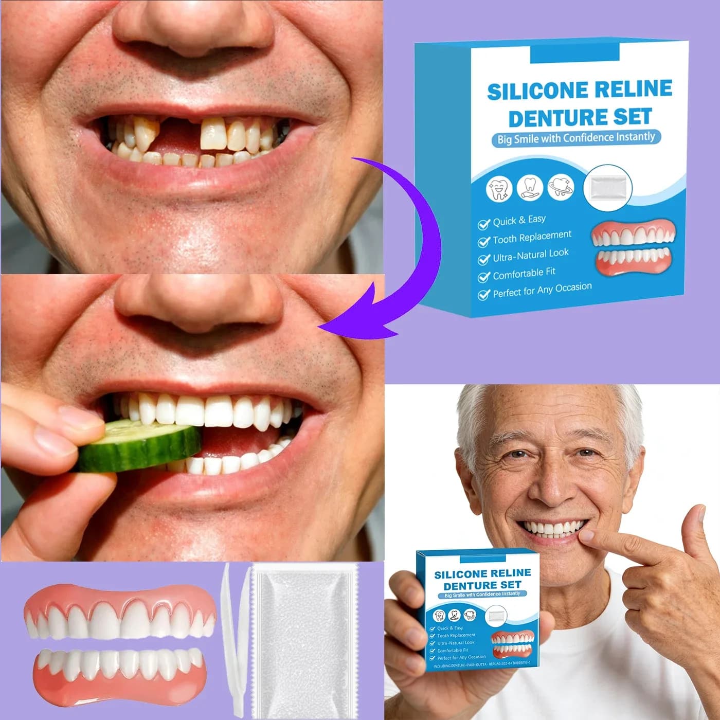Silicone Denture Liner Kit – Soft Upper & Lower