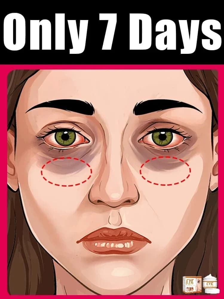 Anti‑wrinkle Eye Cream for Dark Circles and Puffiness