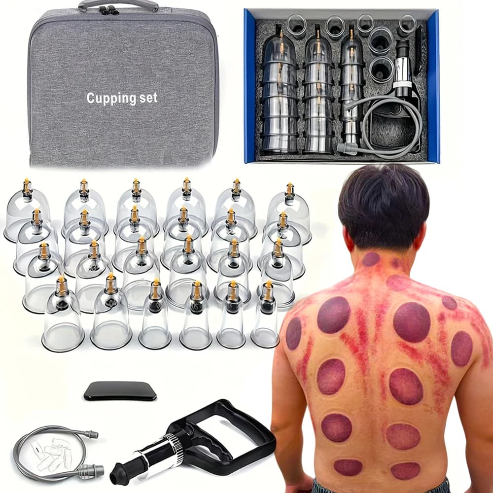 Cupping Relax Set – 24 Vacuum Cups with Hand Pump