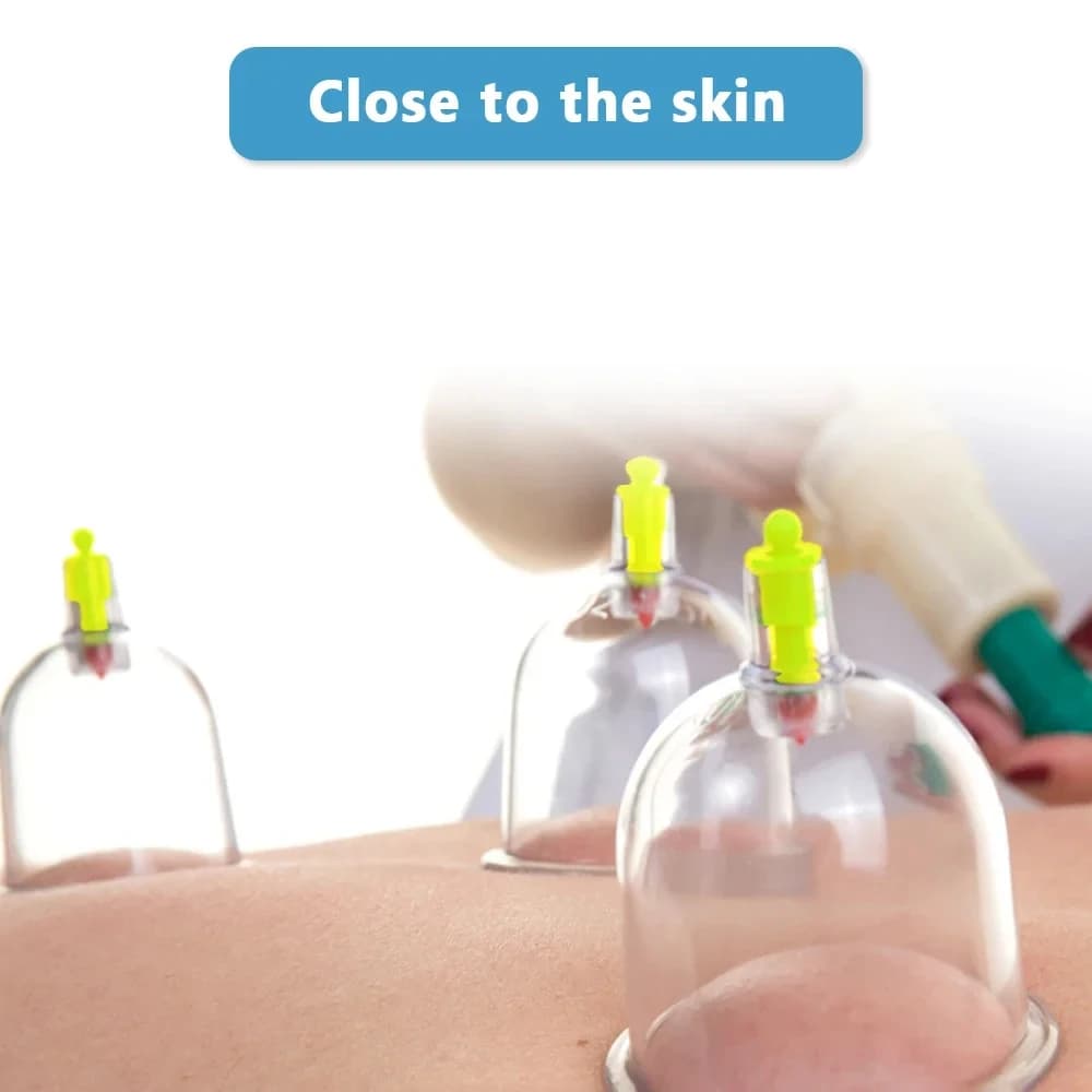 vacuum cupping set with 12 plastic cups — image 6