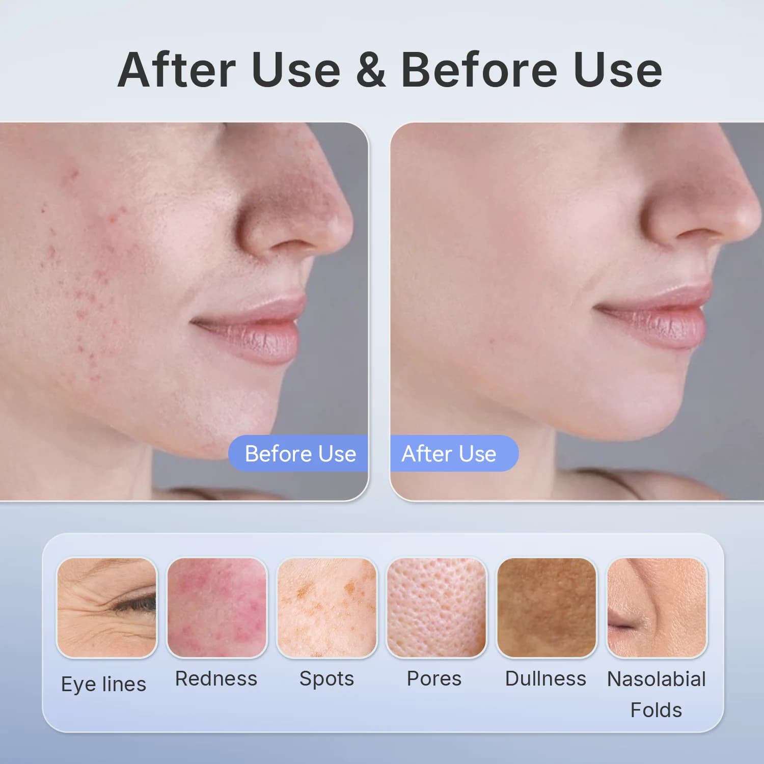 wireless near-infrared red light therapy facial mask — image 6