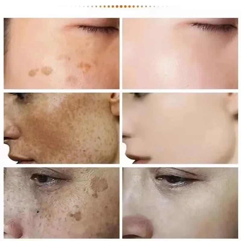 spot removing brightening cream jar — image 4