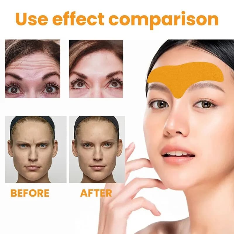 forehead wrinkle patch applied to skin — image 5