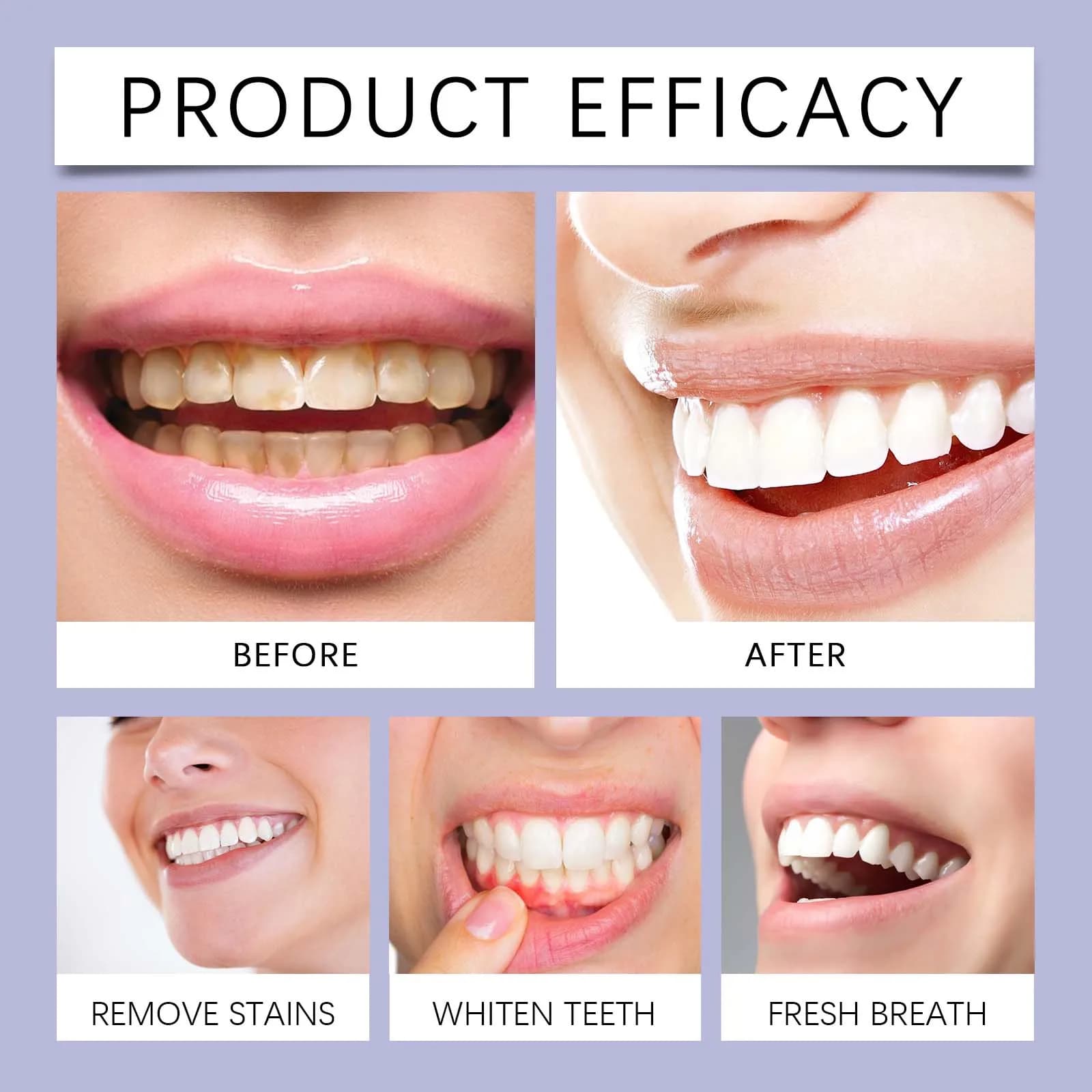 bottles of natural teeth whitening mouthwash — image 3