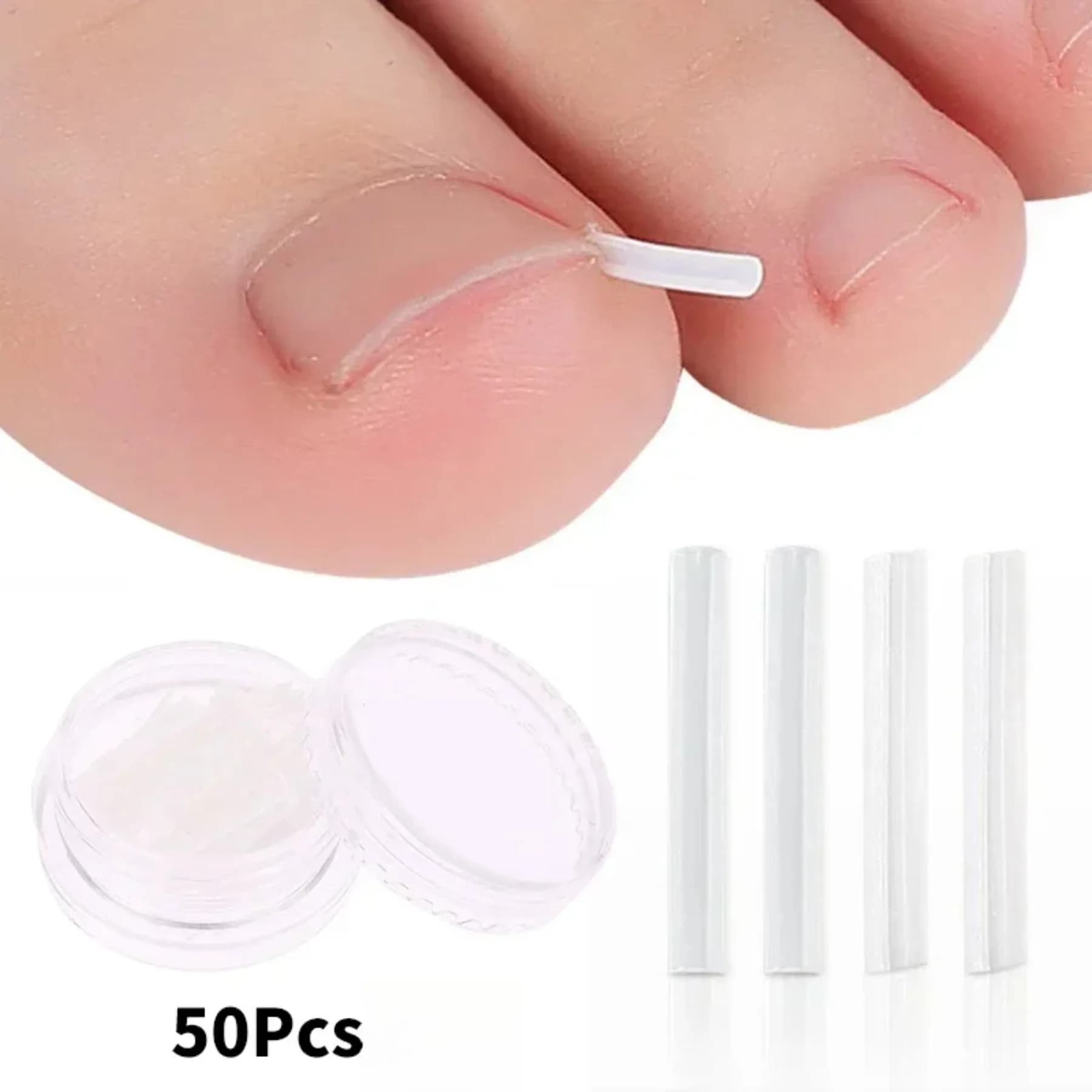 set of 50 elastic ingrown toenail clips — image 1