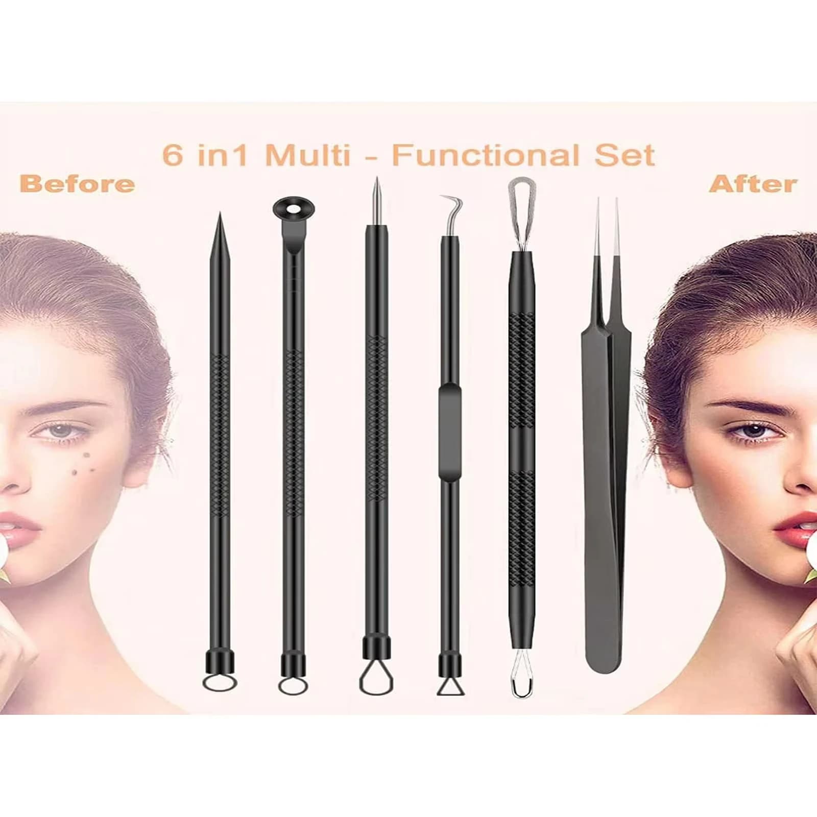 six-piece stainless steel acne needle and clip set — image 5
