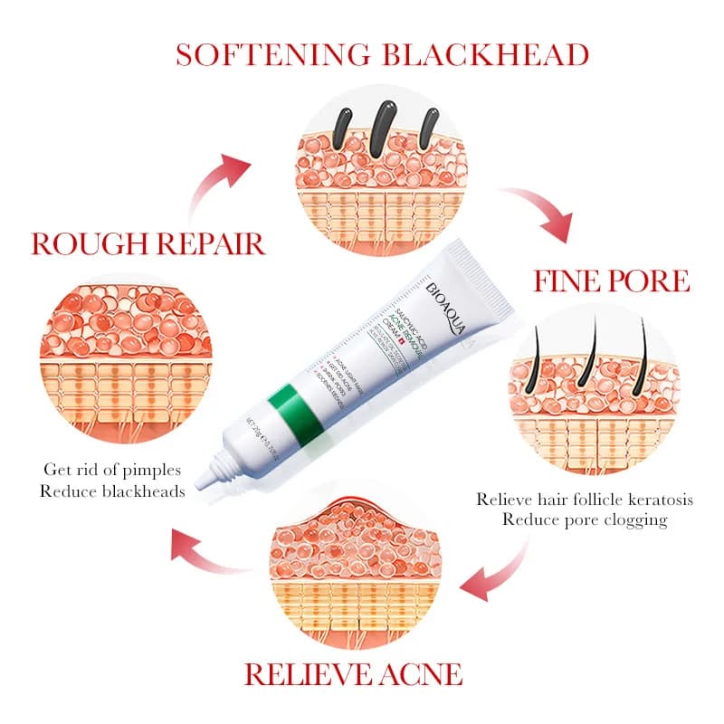salicylic acid face cream tube — image 4