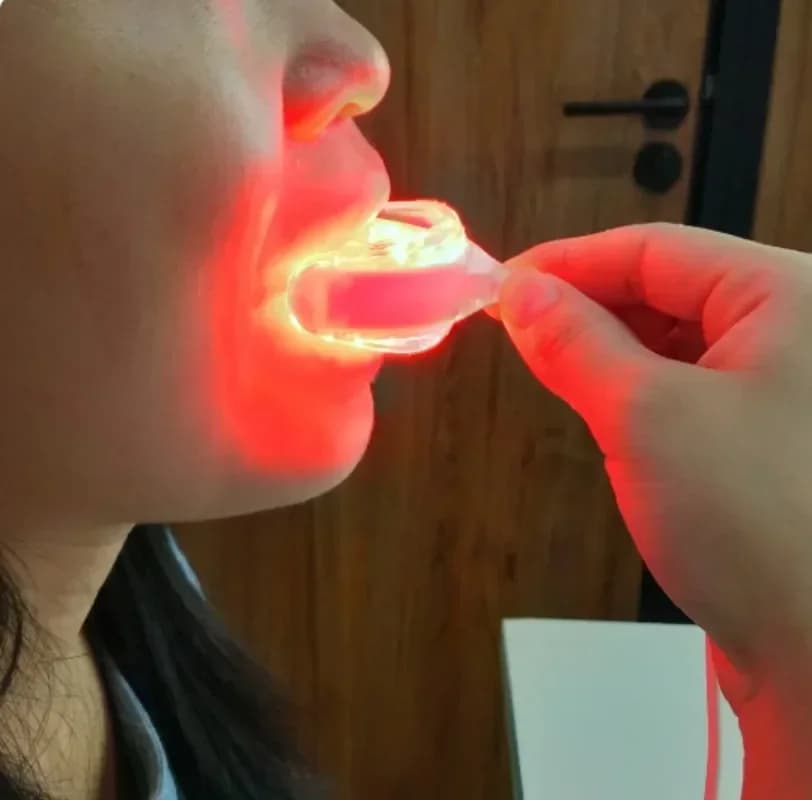 Starlite Smile Red Light Therapy for Gum Health