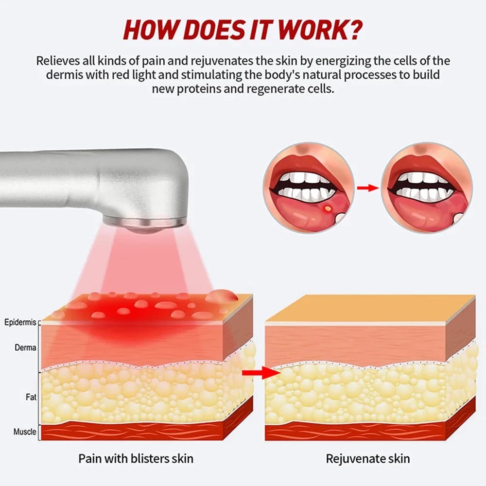 hand-held red and near-infrared light therapy wand for cold sores — image 4