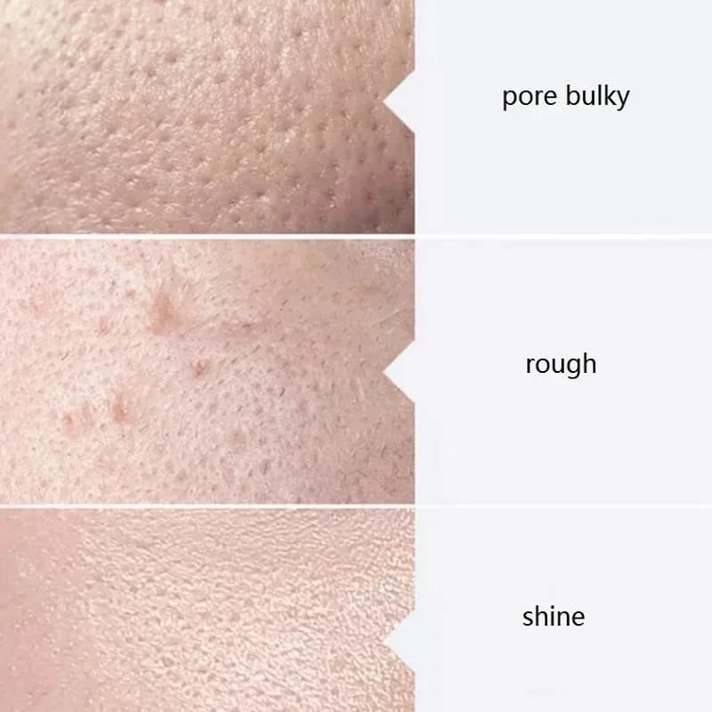Aqua Peel facial serum bottles — image 5
