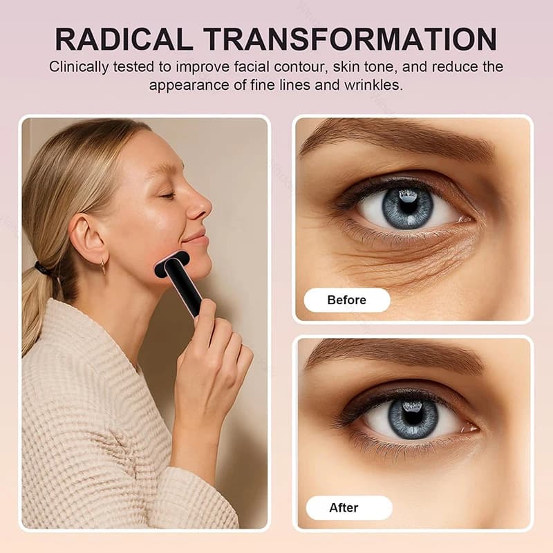7-color light therapy wand with hot compress — image 4