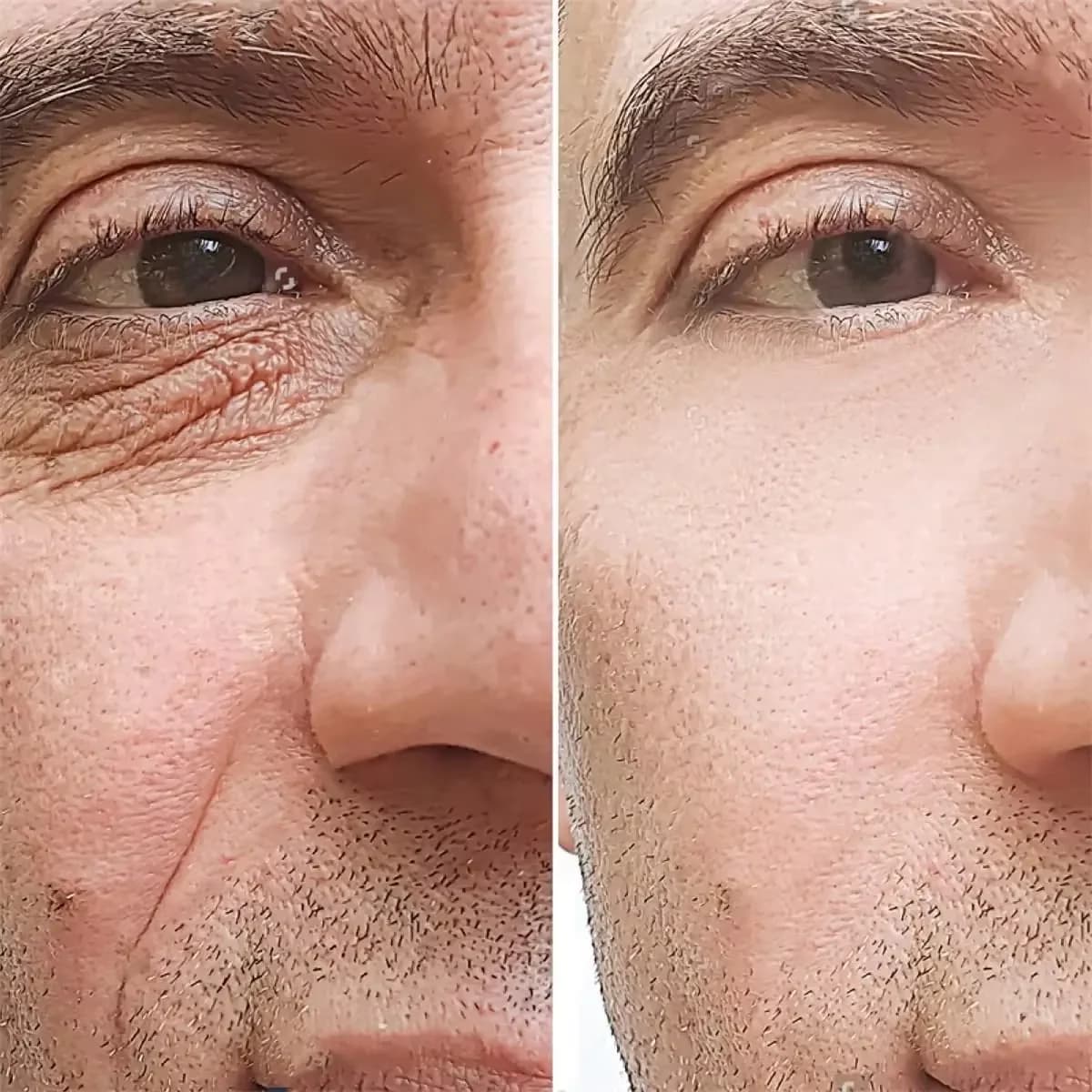 tube of men's retinol anti‑wrinkle cream — image 3