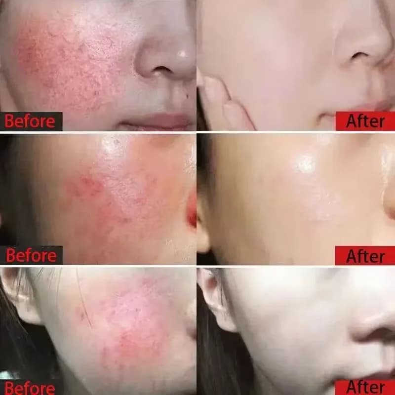 Jar of redness relief facial cream — image 2