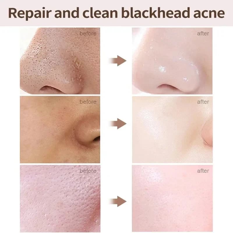 salicylic acid pore refining cream tube — image 3