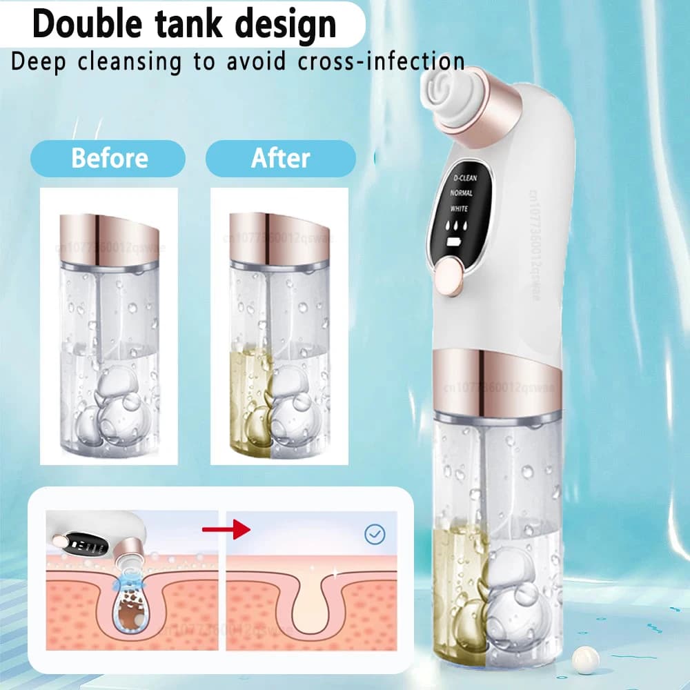 electric pore vacuum blackhead remover — image 4