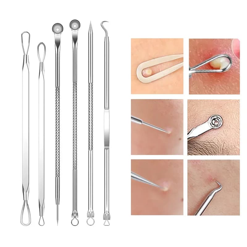 Ingrown hair tweezers with multiple needle tips — image 3