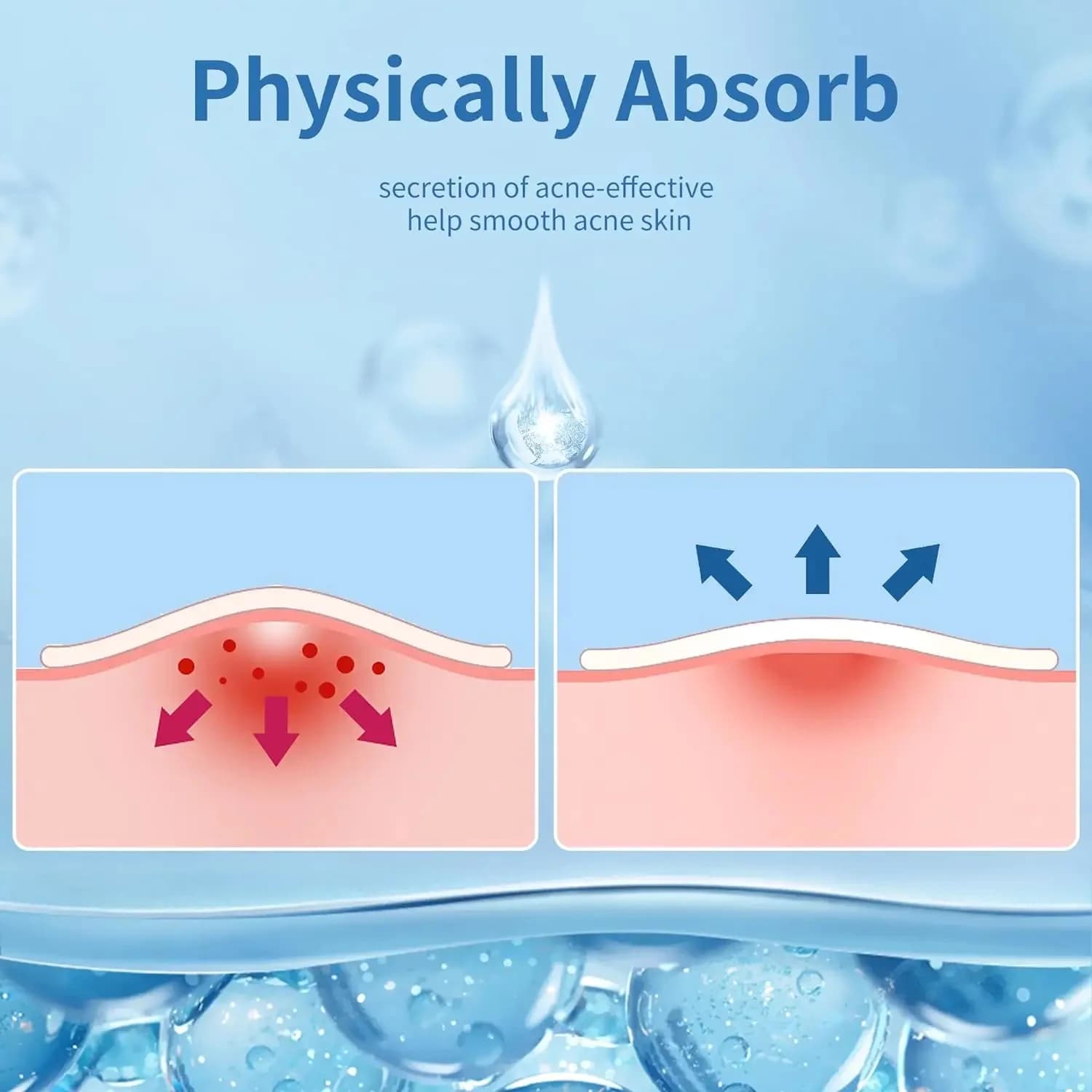 hydrocolloid acne stickers pack of 24 — image 2