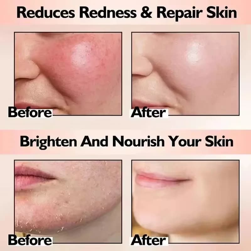 redness relief moisturizing cream tube — image 2