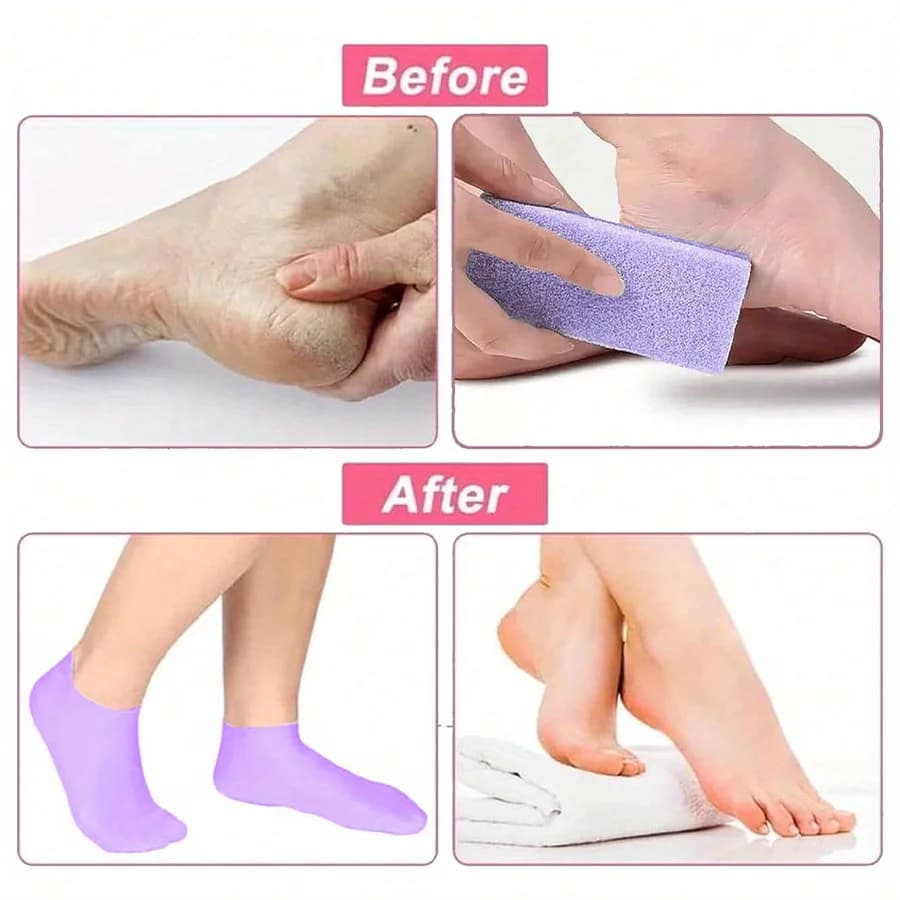 silicone moisturizing foot socks — image 5