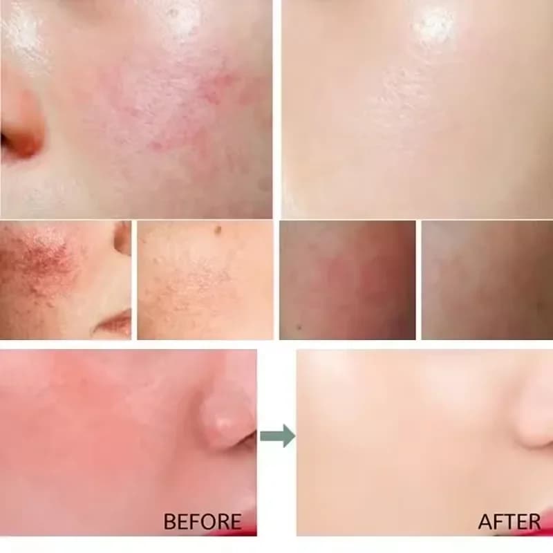 redness relief moisturizing cream tube — image 4