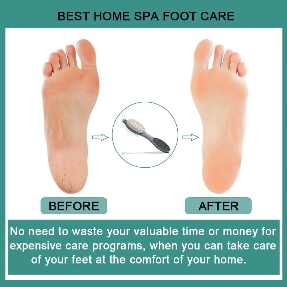 4-in-1 pedicure foot scrubber with brush and callus file — image 5
