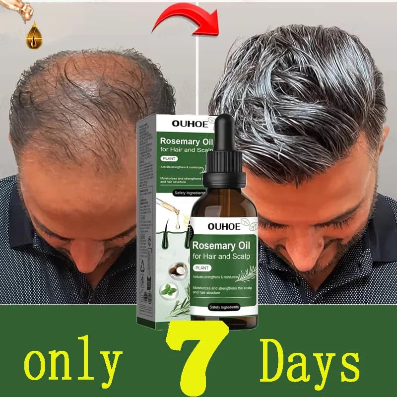 Rosemary Mint Hair Growth Oil