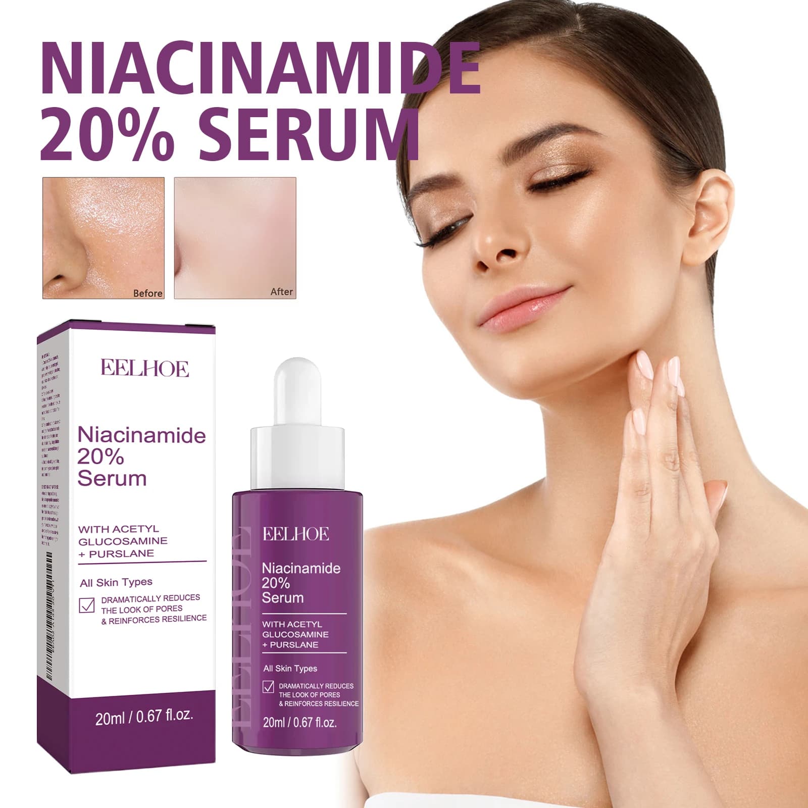20% Niacinamide Serum for Discoloration & Pores