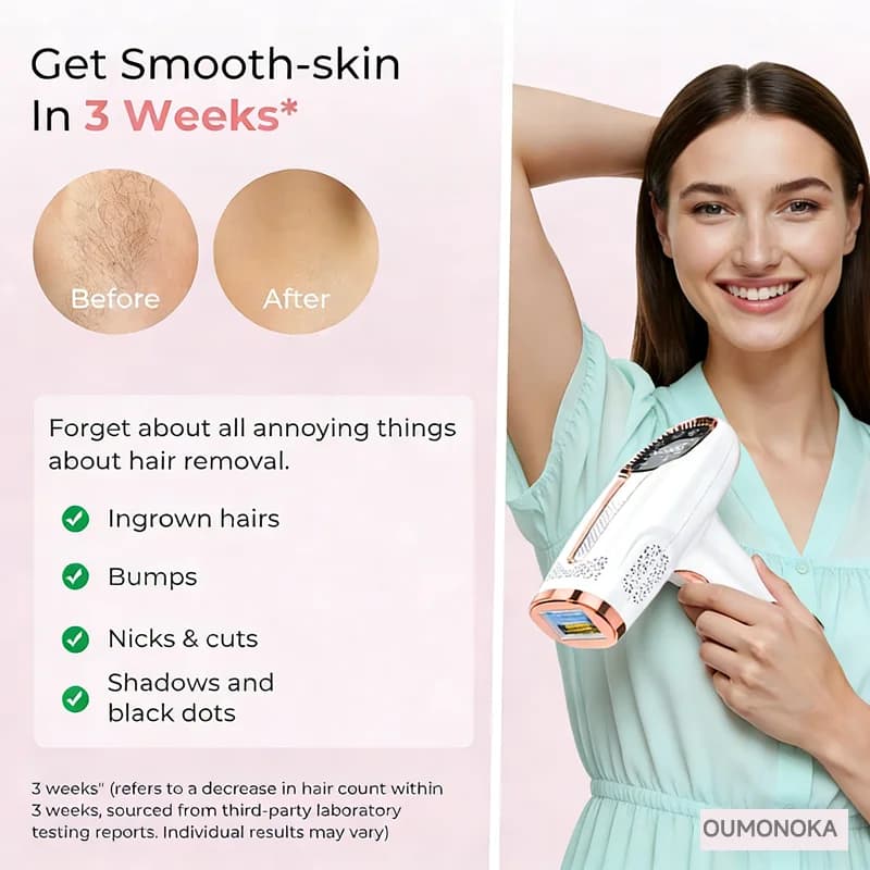 handheld IPL laser epilator with 999,999 flashes — image 3