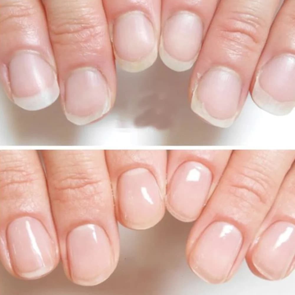 Tinovo Uno natural nail growth complex bottle — image 5