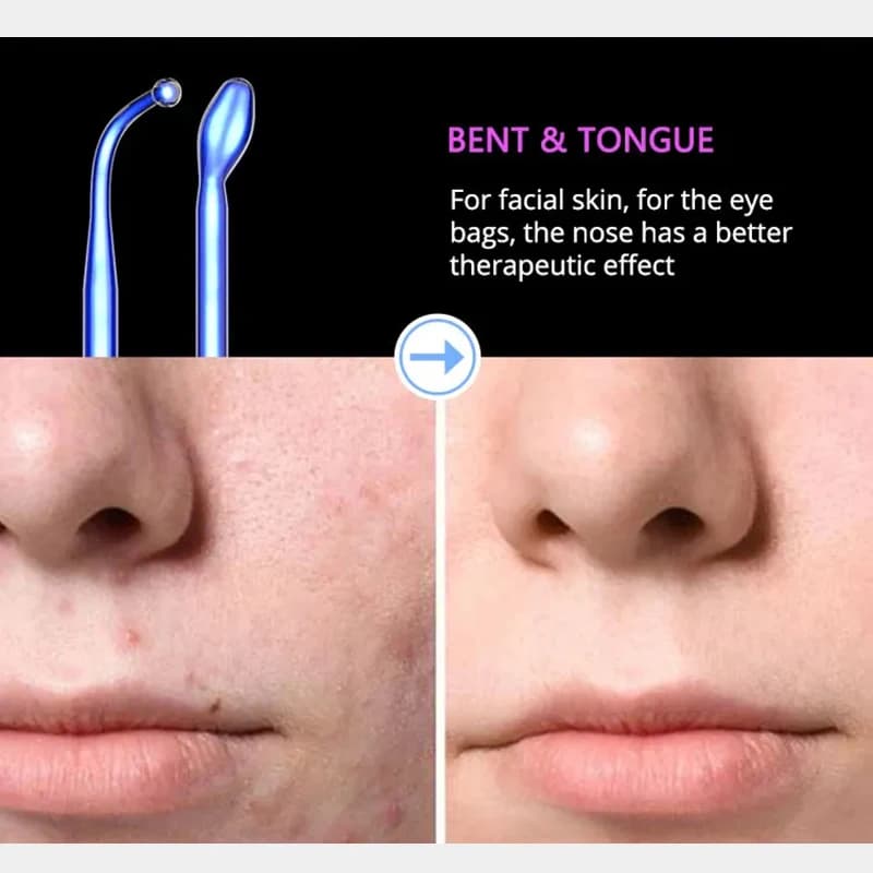 blue high frequency facial device with neon and argon wands — image 4