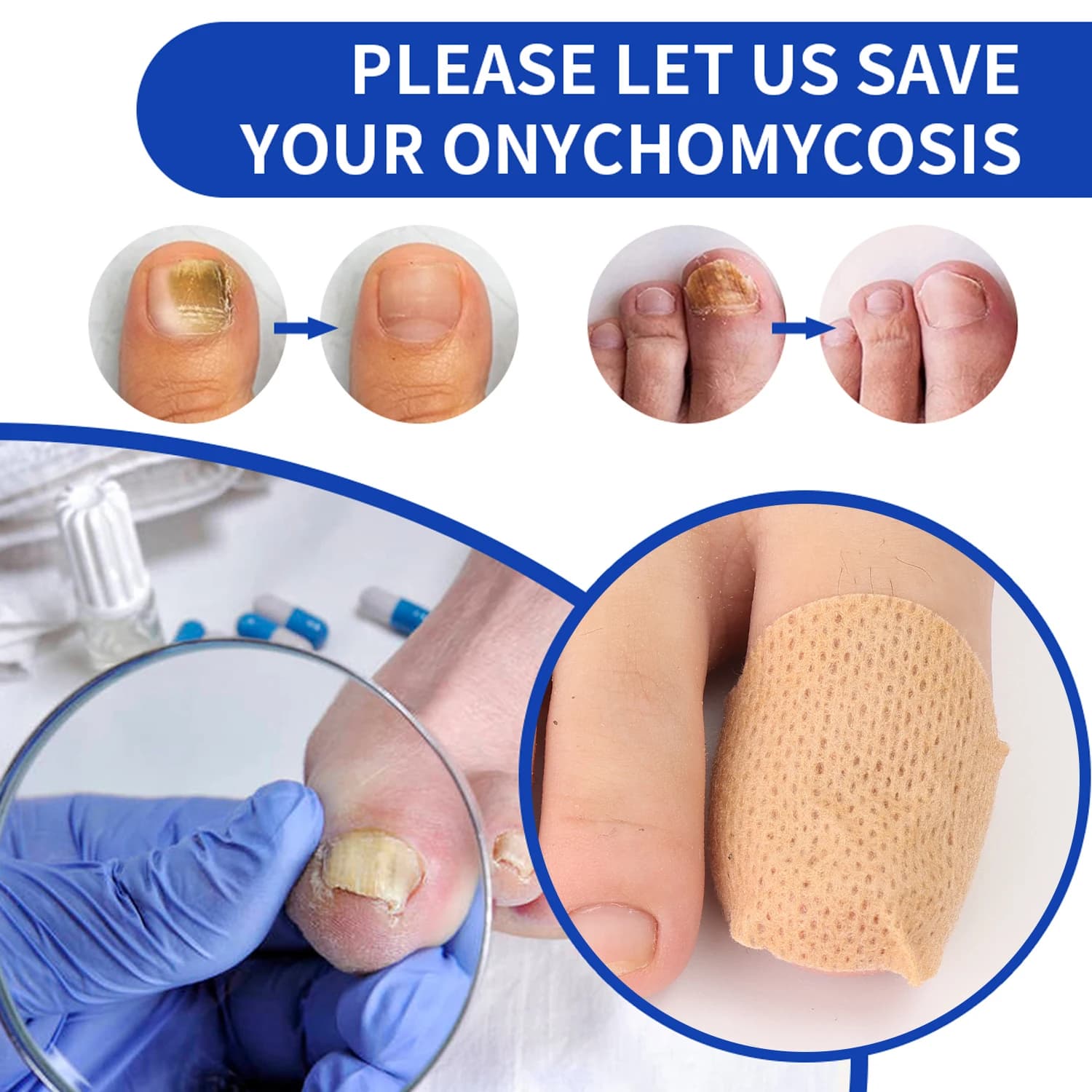 sticky nail repair patches for fungus and ingrown toenails — image 6